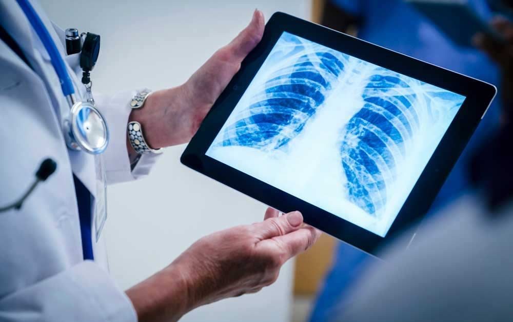 Provider reviewing a chest X-ray