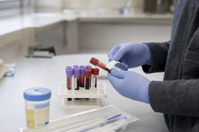Vaso para muestras sellado, tubos de sangre tapados e hisopos empaquetados sobre un mostrador de la clínica, listos para las pruebas de laboratorio
